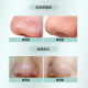 JUJY Aqua Peeling  灌肤级家用智能暖吸冷收毛孔清洁机 专用精华 200ml