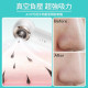 JUJY Visual Hot and Cold Compress Blackhead Machine