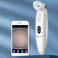 Vita-lité - Blackhead Remover|Come with 4 types of suction heads|6-speed adjustment