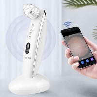 Vita-lité - Blackhead Remover (with HD Macro Camera)|Come with 4 types of suction heads|6-speed adjustment| 20 times magnification microscope lens wifi connection
